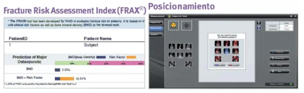 Sistema de densitometría ósea DXA PRIMUS Osteosys - Image 2