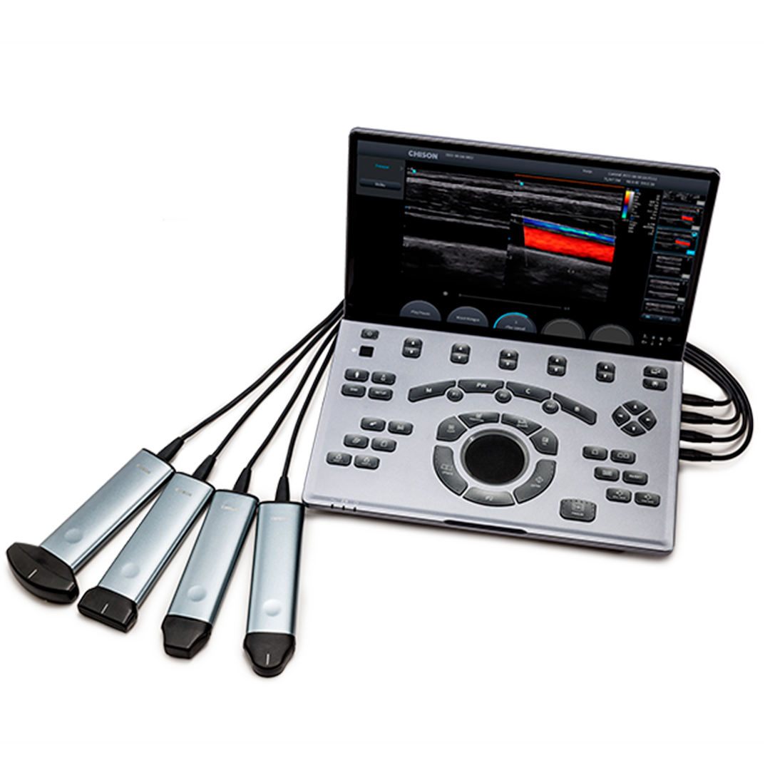 Sistema de Ultrasonido Portátil CHISON SonoAir