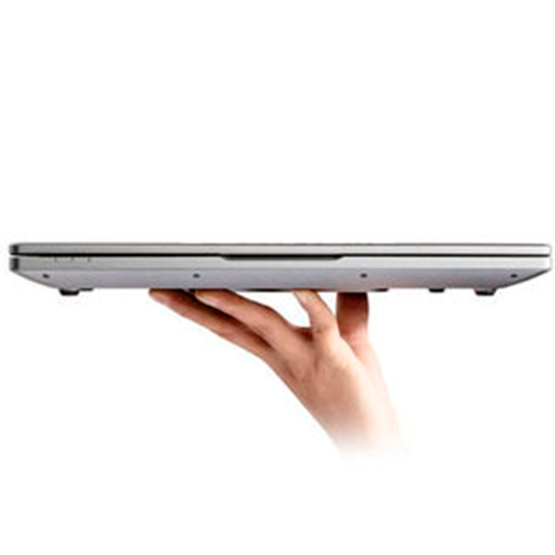 Sistema de Ultrasonido Portátil CHISON SonoAir - Image 6