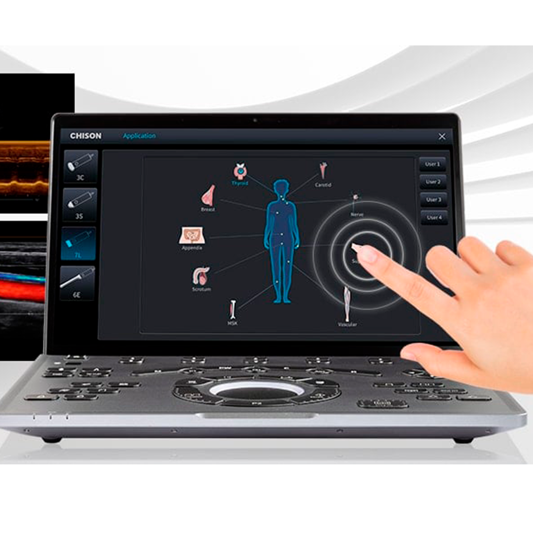 Sistema de Ultrasonido Portátil CHISON SonoAir - Image 2