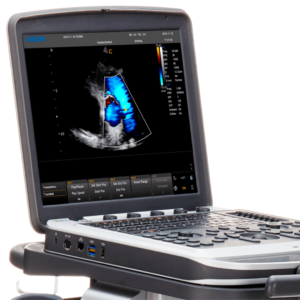 Sistema de Ultrasonido Portátil CHISON SonoBook