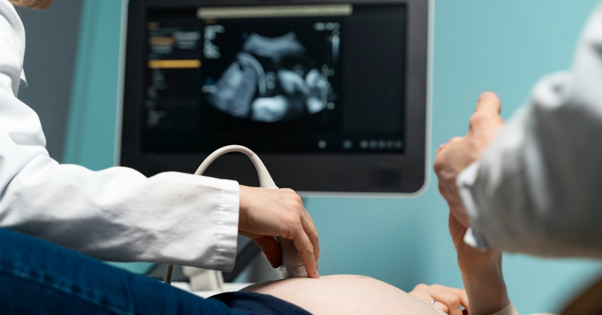 Ultrasonidos-generales-Sistemas-Sonosite