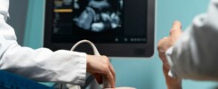 Ultrasonidos-generales-Sistemas-Sonosite